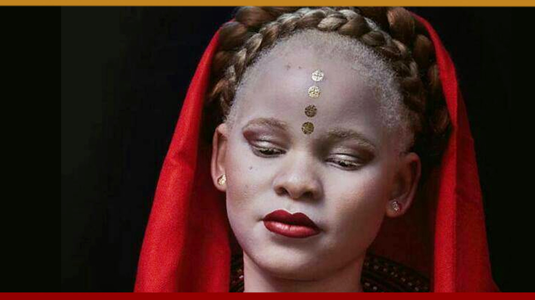 #CelebratingWomenWithAlbinism