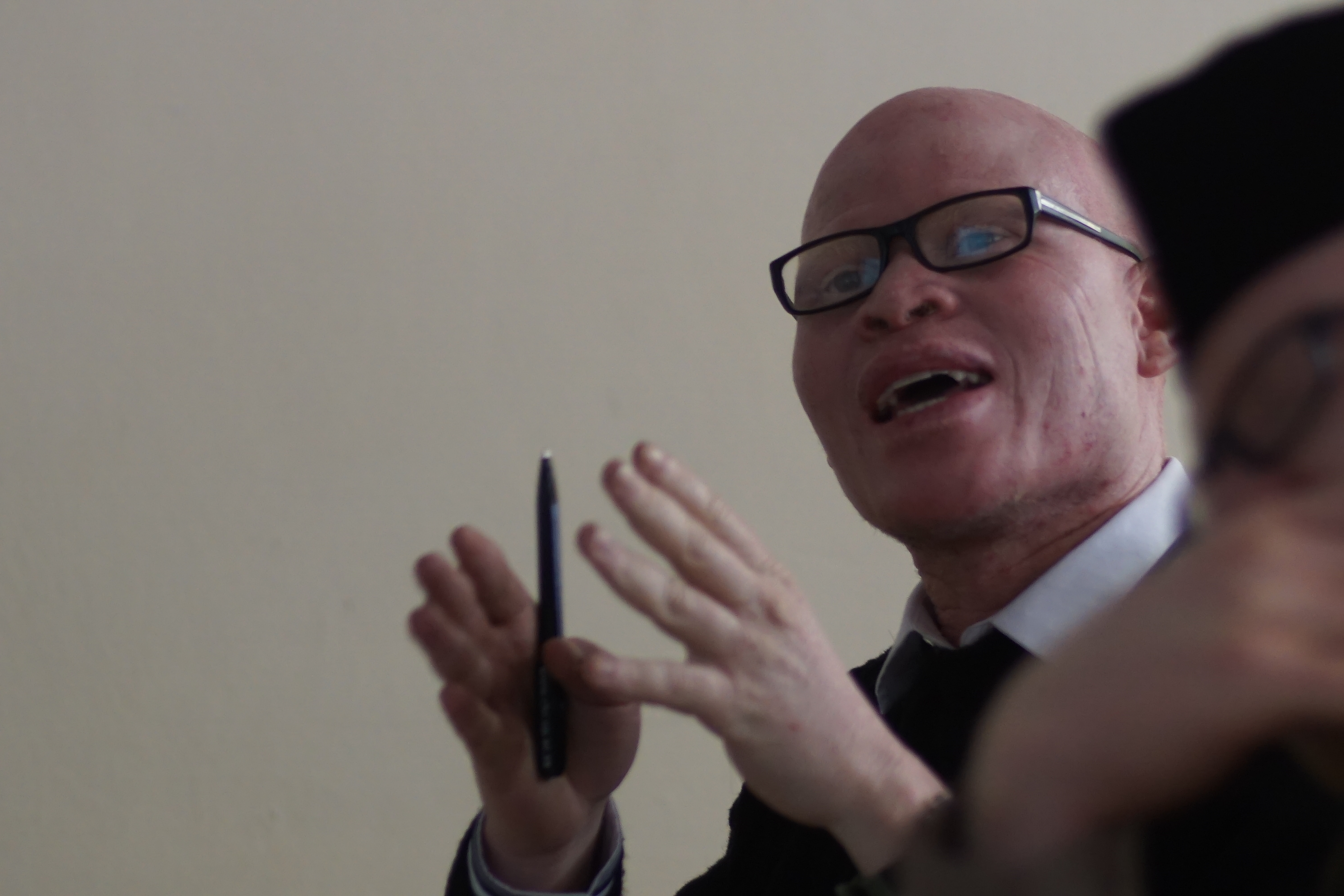 Capacitating frontline organisations working to advance the rights of persons with albinism in Africa
